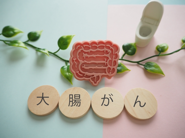 大腸がんのイメージ図｜腸内のポリープやがん細胞の発生を解説